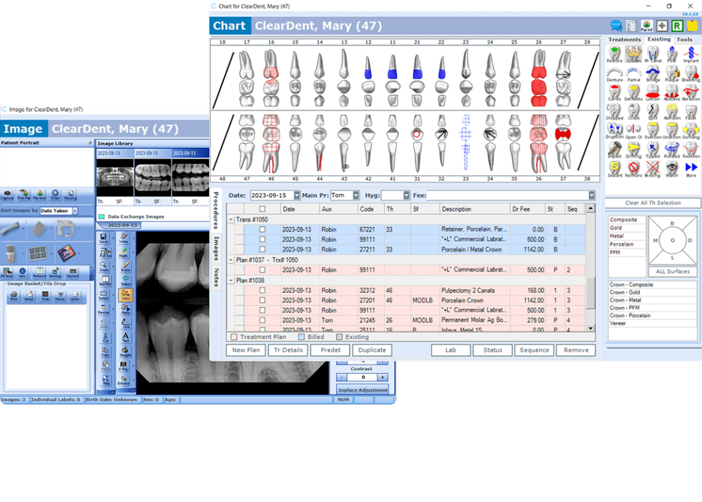 cleardent on premise clinical workflow